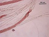 3 - Dettaglio dei tricoblasti